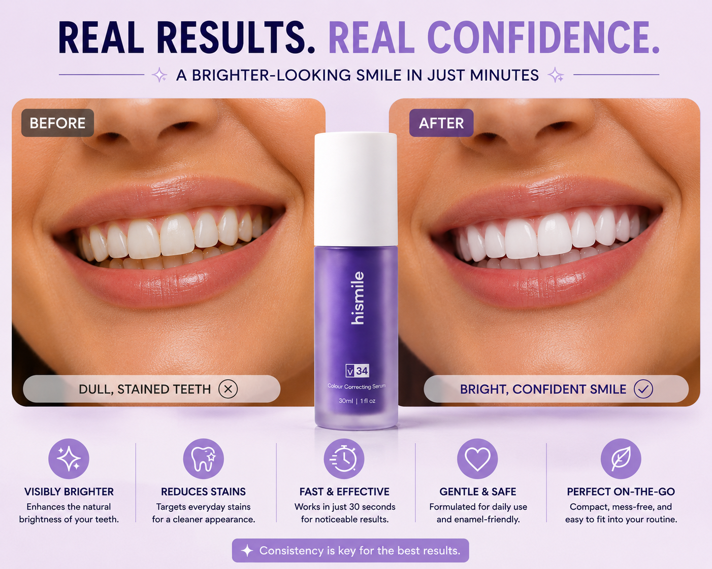 Novera Teeth Whitening Serum