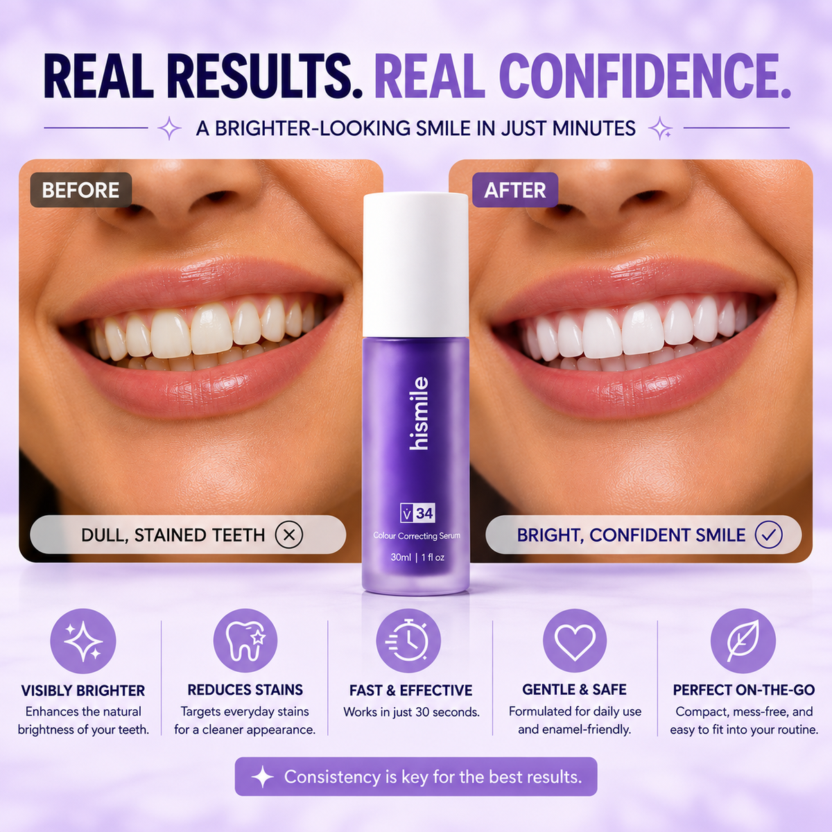Novera Teeth Whitening Serum