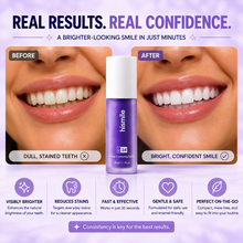 Novera Teeth Whitening Serum